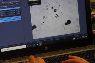 Various types of algae and microscopic creatures from a water sample are viewed on a computer screen.